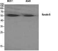 Cytokeratin 8 Polyclonal Antibody
