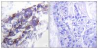 Cytokeratin 8 Polyclonal Antibody