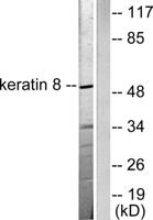 Cytokeratin 8 Polyclonal Antibody