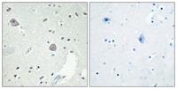 D1DR Polyclonal Antibody