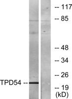 D54 Polyclonal Antibody