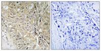 D55 Polyclonal Antibody