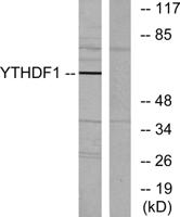 DACA-1 Polyclonal Antibody