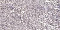 DACA-1 Polyclonal Antibody