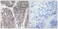 DAN Polyclonal Antibody