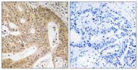 DAP-1 Polyclonal Antibody