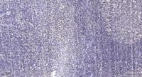 DAP-5 Polyclonal Antibody