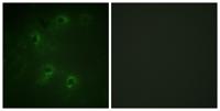 DAPK1 Polyclonal Antibody