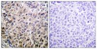 DAPK1 Polyclonal Antibody