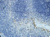 DAPK2 Polyclonal Antibody