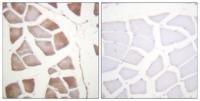 DAPK2 Polyclonal Antibody
