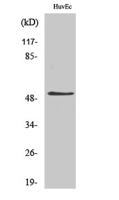 DAPK3 Polyclonal Antibody