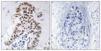 DAPK3 Polyclonal Antibody