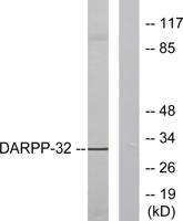 DARPP-32 Polyclonal Antibody