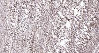 Daxx Polyclonal Antibody