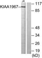 DBC-1 Polyclonal Antibody