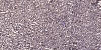 DBC-1 Polyclonal Antibody