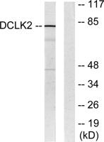 DCAMKL2 Polyclonal Antibody