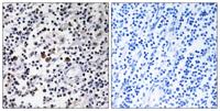 DCL-1 Polyclonal Antibody