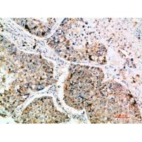 DC-LAMP Polyclonal Antibody