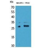 DcR1 Polyclonal Antibody