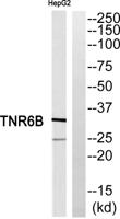 DcR3 Polyclonal Antibody