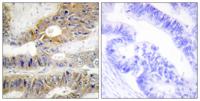 DcR3 Polyclonal Antibody