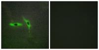 DcR3 Polyclonal Antibody
