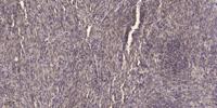 DD1 Polyclonal Antibody
