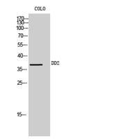 DD2 Polyclonal Antibody