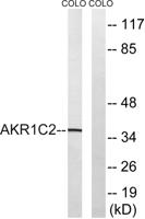 DD2 Polyclonal Antibody