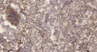 DD2 Polyclonal Antibody