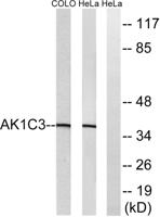 DD3 Polyclonal Antibody
