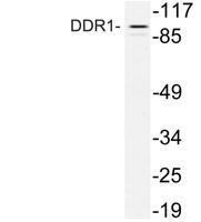 DDR1 Polyclonal Antibody