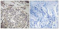 AMPKα1 Polyclonal Antibody