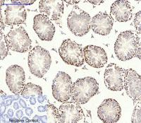 AMPKα1/2 Polyclonal Antibody