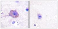 AMPKβ1 Polyclonal Antibody