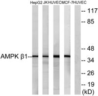 AMPKβ1 Polyclonal Antibody