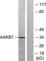AMPKβ1 Polyclonal Antibody