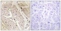 AMPKγ2 Polyclonal Antibody