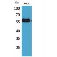Amylase Polyclonal Antibody