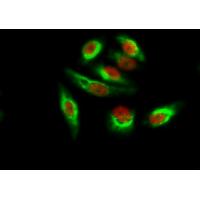 Amyloid-β Polyclonal Antibody