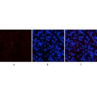 Amyloid-β Polyclonal Antibody