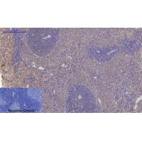Amyloid-β Polyclonal Antibody
