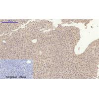 Amyloid-β Polyclonal Antibody