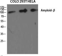 Amyloid-β Polyclonal Antibody