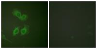 Amyloid-β Polyclonal Antibody