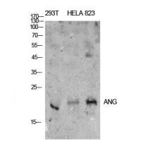 ANG I Polyclonal Antibody