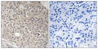 Angiomotin-L1 Polyclonal Antibody