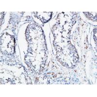 Angptl4 Polyclonal Antibody